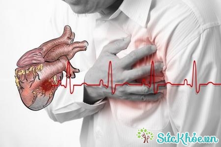Nguyên nhân suy tim có thể do rối loạn nhịp tim, tăng huyết áp...