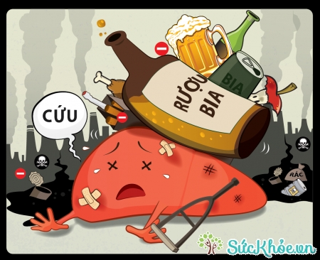 Rượu bia là tác nhân chủ yếu gây bệnh xơ gan