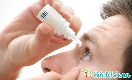 Dùng thuốc nhỏ mắt kháng histamin để chữa bệnh viêm kết mạc cấp tính