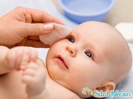 Cách điều trị viêm tắc tuyến lệ ở trẻ sơ sinh thường dùng nhất là vệ sinh mắt