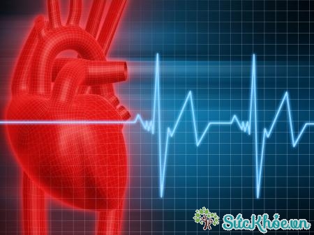 Sau nhồi máu cơ tim, người bệnh dễ bị rối loạn nhịp tim