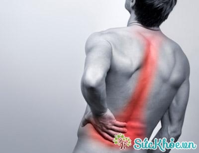 Bệnh thoát vị đĩa đệm cột sống khiến người bệnh bị đau lưng nặng và khó cử động