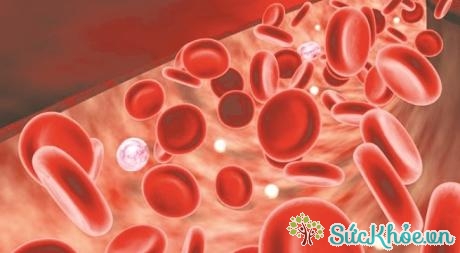 Sự bất thường trong huyết cầu tố dẫn tới tình trạng thiếu máu