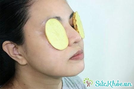 Dùng khoai tây đắp lên vùng mắt bị đau cũng là cách chữa đau mắt đỏ tại nhà nhanh nhất