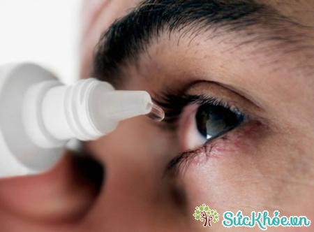 Cách chữa đau mắt đỏ nhanh nhất sau đây sẽ làm giảm các triệu chứng khó chịu gây ra cực hiệu quả