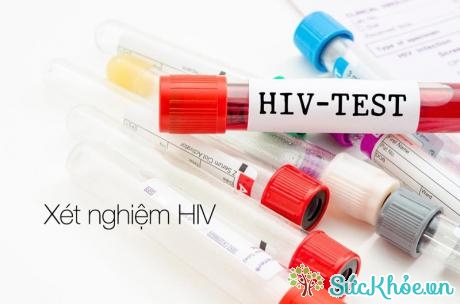 Xét nghiệm HIV trực tiếp