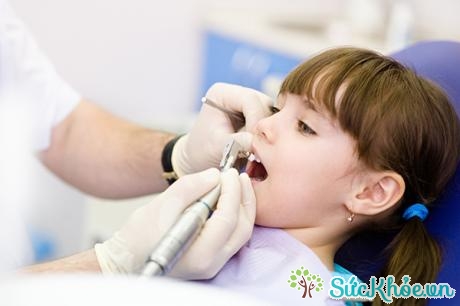 Điều trị sâu răng sữa có chi phí điều trị nha khoa cao