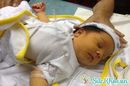 Cách kiểm tra vàng da ở trẻ sơ sinh không hề khó