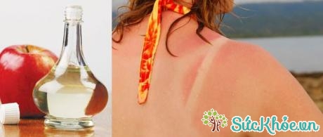 Dấn táo không chỉ làm sáng da mà còn có tác dụng trị da sạm do cháy nắng