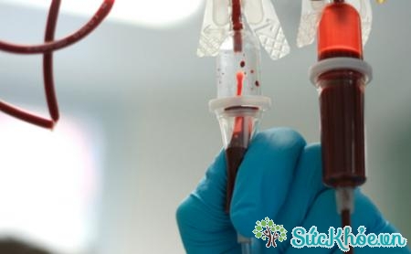 Người bệnh viêm tụy có thể cần được truyền máu