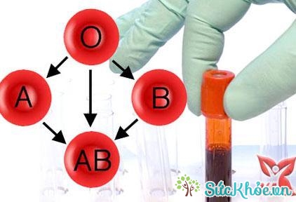 Xét nghiệm máu để xác định nhóm máu