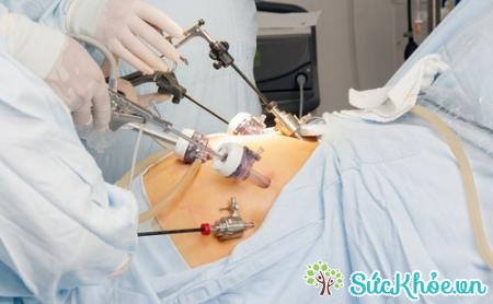 Phương pháp điều trị bằng cách phẫu thuật túi mật