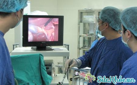 Với căn bệnh polyp túi mật, bác sĩ có thể sẽ thực hiện phẫu thuật cắt túi mật
