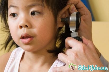 Điều trị viêm tai giữa thanh dịch cần có sự tư vấn của bác sĩ