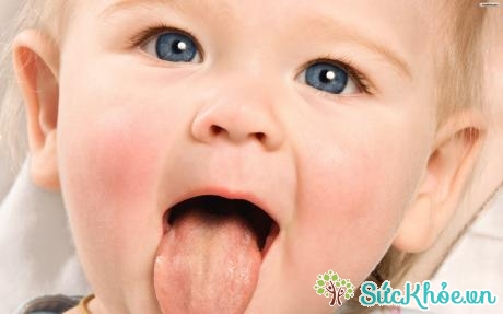Triệu chứng tưa lưỡi ở trẻ nhỏ