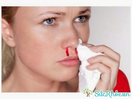 Đè ép cánh mũi và vách mũi để điều trị chảy máu cam
