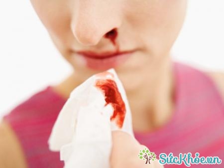 Chảy máu cam khi mang thai do áp lực cho các mạch máu trong mũi lớn