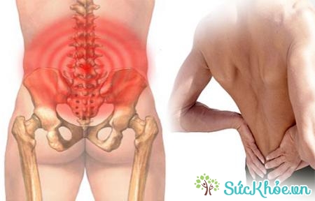 Những cơn đau vùng dưới thắt lưng cũng là triệu chứng viêm tuyến tiền liệt