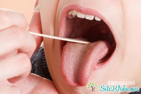 Mắc các bệnh về lưỡi sẽ khó khăn trong ăn uống