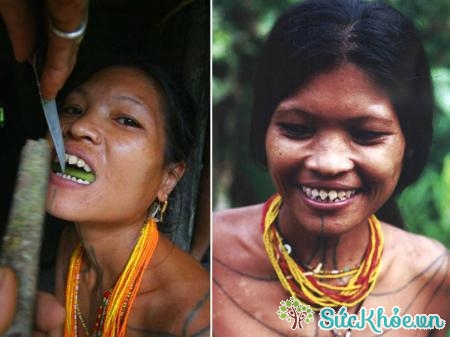  Mài răng là một cách làm đẹp truyền thống của người Indo