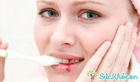 Khi mang thai nướu răng sẽ bị mềm và dễ bị tổn thương