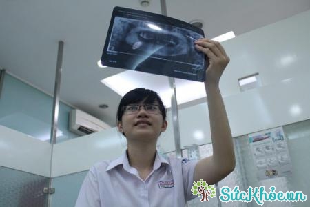 Chụp X - quang là phương pháp chẩn đoán viêm loét dạ dày