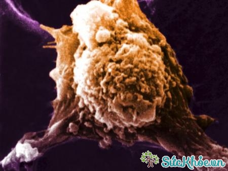 Tế bào tua chuyên trình diện kháng nguyên