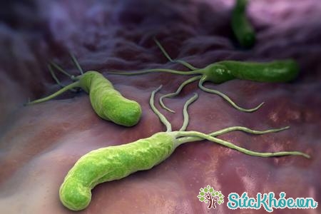 Vi khuẩn gây ung thư dạ dày - vi khuẩn Helicobacter pylori