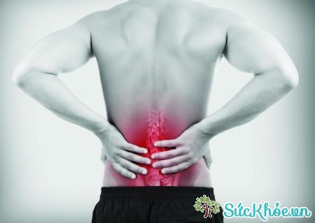 Triệu chứng của đau thần kinh tọa là các cơn đau thắt lưng