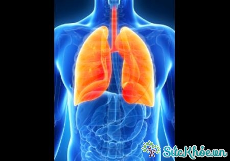 Phù phổi cấp là tình trạng ngạt thở cấp