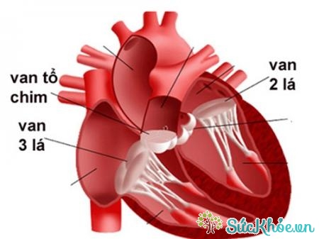 Hở van động mạch chủ là van động mạch chủ không đóng