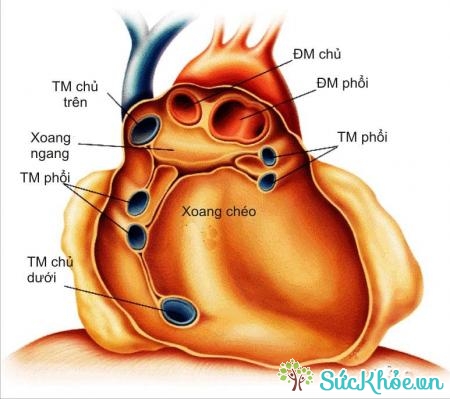 Những nguyên nhân và bệnh lý gây tràn dịch màng tim