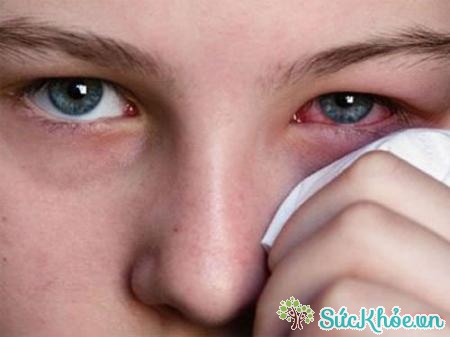 Đau mắt là một triệu chứng của lông quặm