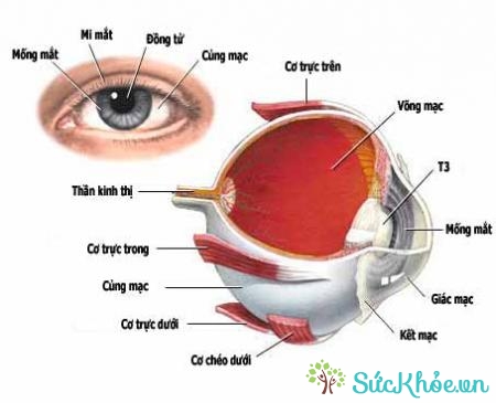 Tật khúc xạ là rối loạn mắt phổ biến