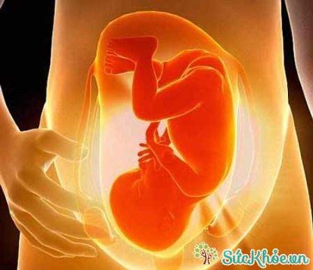 Ảnh hưởng của thai chết lưu với thai phụ là nước ối sẽ vỡ sớm