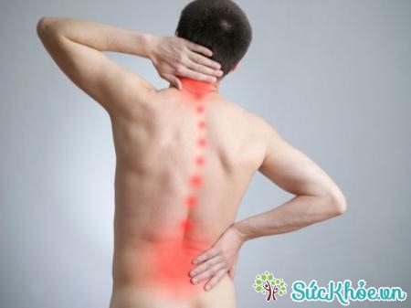 Thoát vị đĩa đệm thắt lưng là nguyên nhân đau thần kinh tọa thường gặp nhất