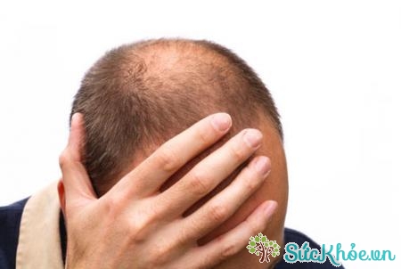 Phẫu thuật hay ốm đau là một nguyên nhân rụng tóc ở nam giới phổ biến
