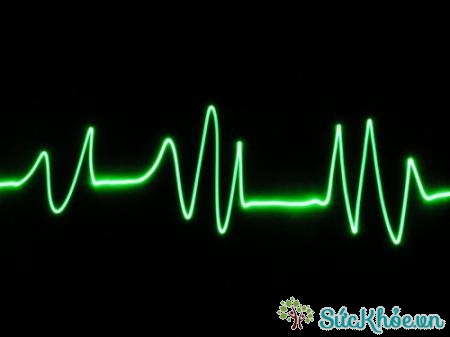 Nhịp tim đập nhanh là một biểu hiện ngộ độc thuốc tại tim mạch