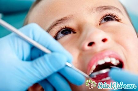 Lấy cao răng giúp bảo tồn răng của trẻ tối đa