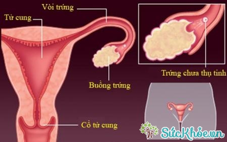 Viêm buồng trứng trái ảnh hưởng lớn đến sức khỏe sinh sản