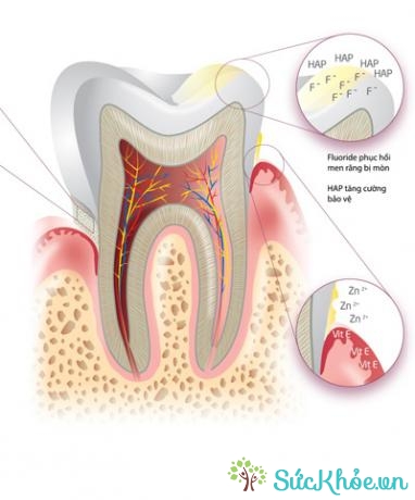 Ngoài ra, đối với trường hợp răng nhạy cảm, hay ê buốt (chiếm khoảng 20 - 30% người lớn), cách phục hồi tận gốc là phải bịt kín các ống ngà hở.