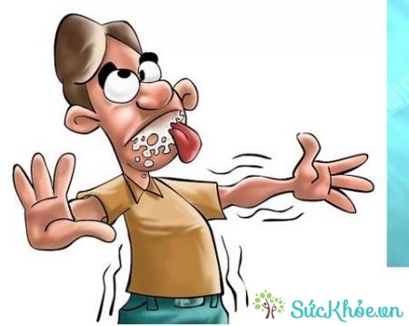 Thận trọng với người có tiền sử động kinh