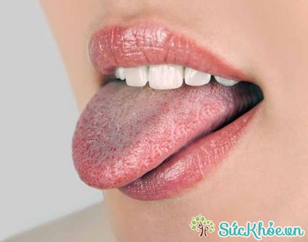 Người bệnh có thể bị mất vị giác khi mắc nấm miệng