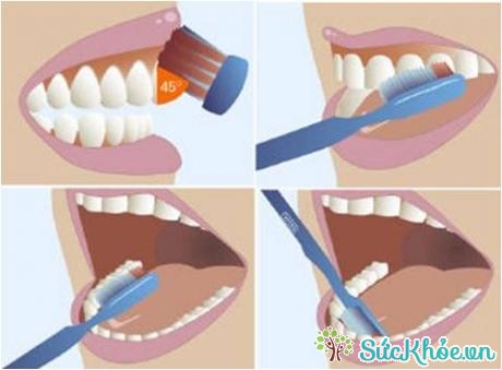  Đặt bàn chải nghiêng một góc 45 độ với hàm răng, chải theo chiều từ chân răng đến mặt nhai
