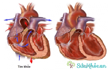 Thận trọng khi dùng với người suy tim sau nhồi máu cơ tim cấp