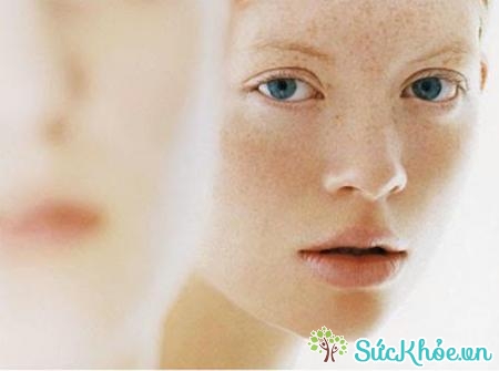Tình trạng tăng sắc tố da là các vết thâm xuất hiện trên da