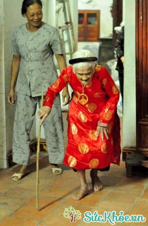 Thoái hóa cột sống gây gù lưng và đi lại khó khăn ở người cao tuổi.