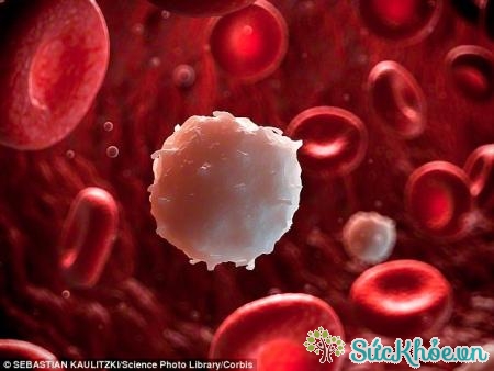 Xơ tủy nguyên phát là bệnh lý do tăng sinh đơn dòng tế bào gốc