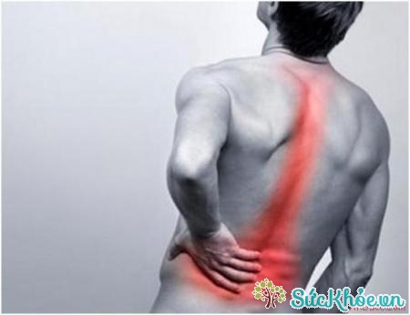 Bệnh nhân thường có biểu hiện đau lưng