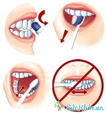 Đánh răng theo chiều ngang và xỉa răng đều là những thói quen sai lầm